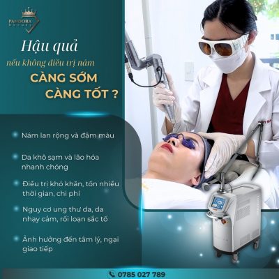 Nên trị nám da càng sớm càng tốt bạn nhé