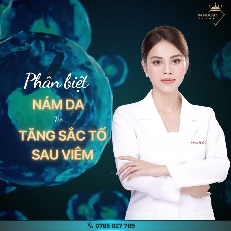 Phân biệt nám da & tăng sắc tố sau viêm!