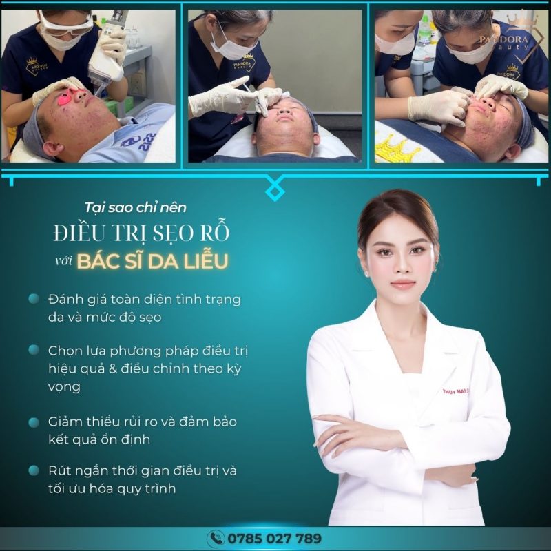 Trị sẹo cùng bác sĩ da liễu!!