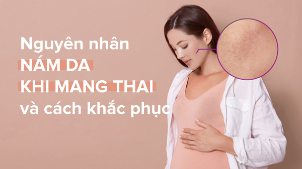 Nguyên nhân nám da khi mang thai!